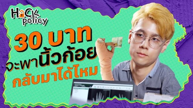 30 บาท จะพานิ้วก้อยกลับมาได้ไหม ?